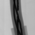 Cables